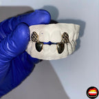 2 Plain Lateral - 2 Diamond Dust Cut Lateral - Bitez Grillz
