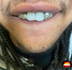 Lateral - Lateral Diamond Dust Cut - Bitez Grillz