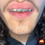 2 x Window Front & Lateral Diamond Dust Cut - Bitez Grillz