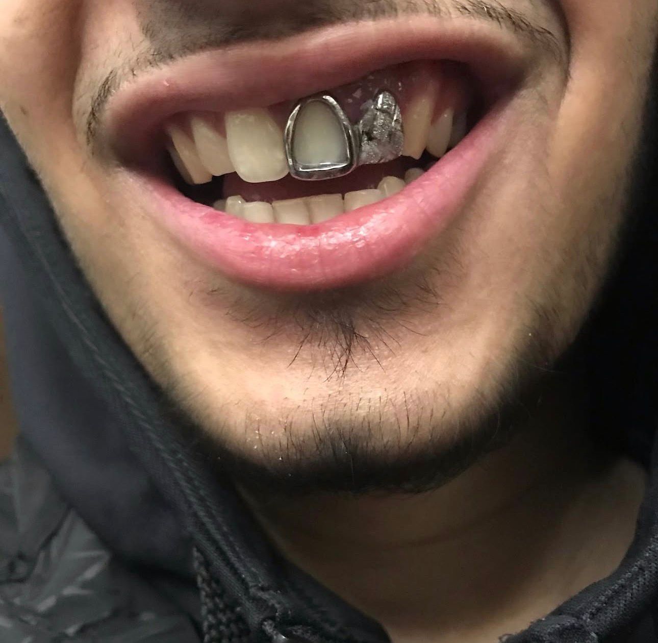 Lateral Diamond Dust Cut & Front Plain Window - Bitez Grillz