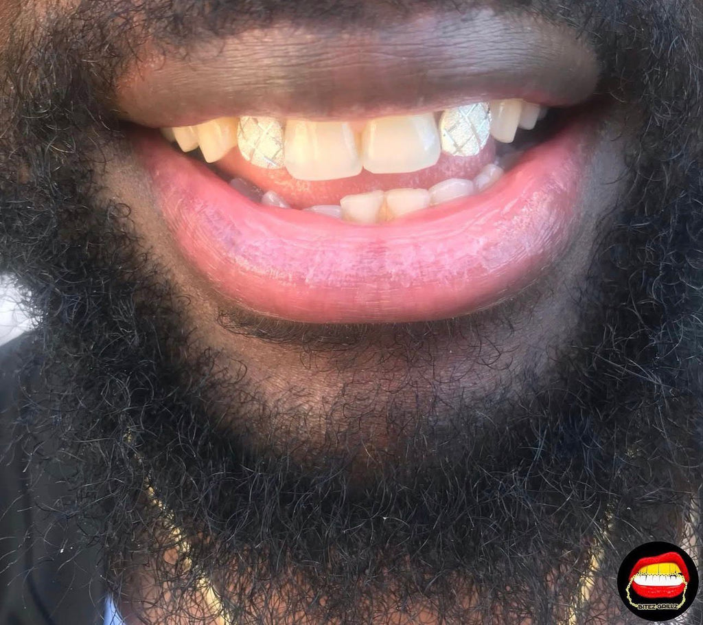 Lateral - Lateral Diamond Dust Cut - Bitez Grillz