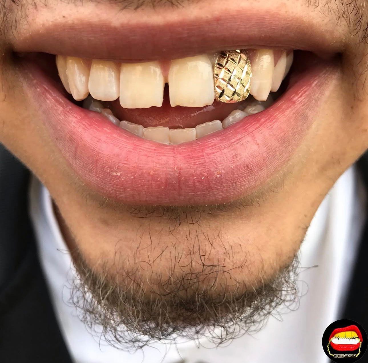Lateral Diamond Dust Cut - Bitez Grillz