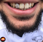 Lateral Diamond Dust Cut - Bitez Grillz