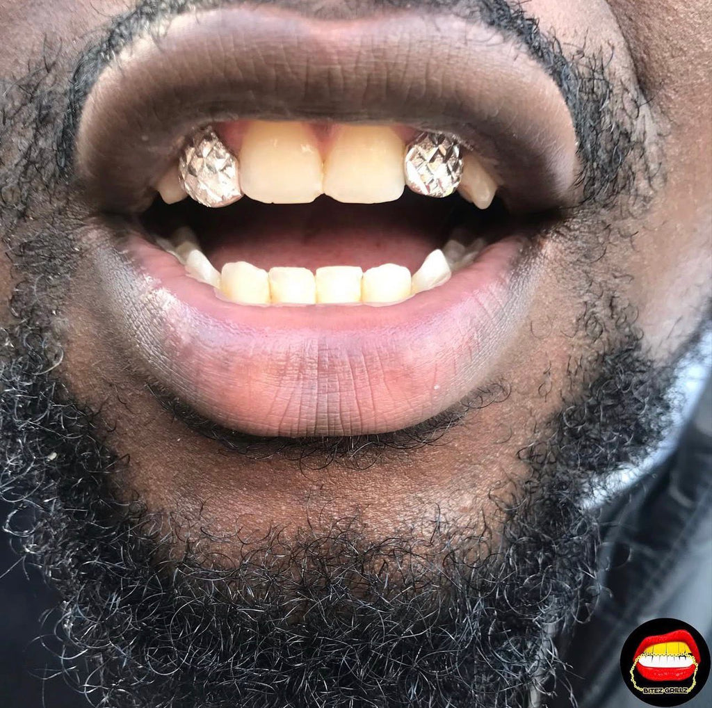 Lateral - Lateral Diamond Dust Cut - Bitez Grillz