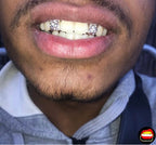 Lateral - Lateral Diamond Dust Cut - Bitez Grillz