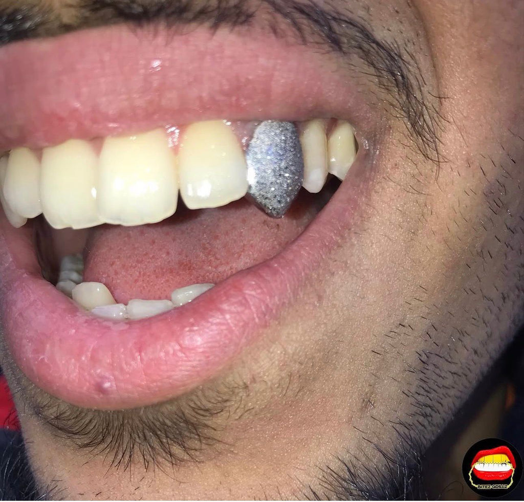 Canine Diamond Dust - Bitez Grillz