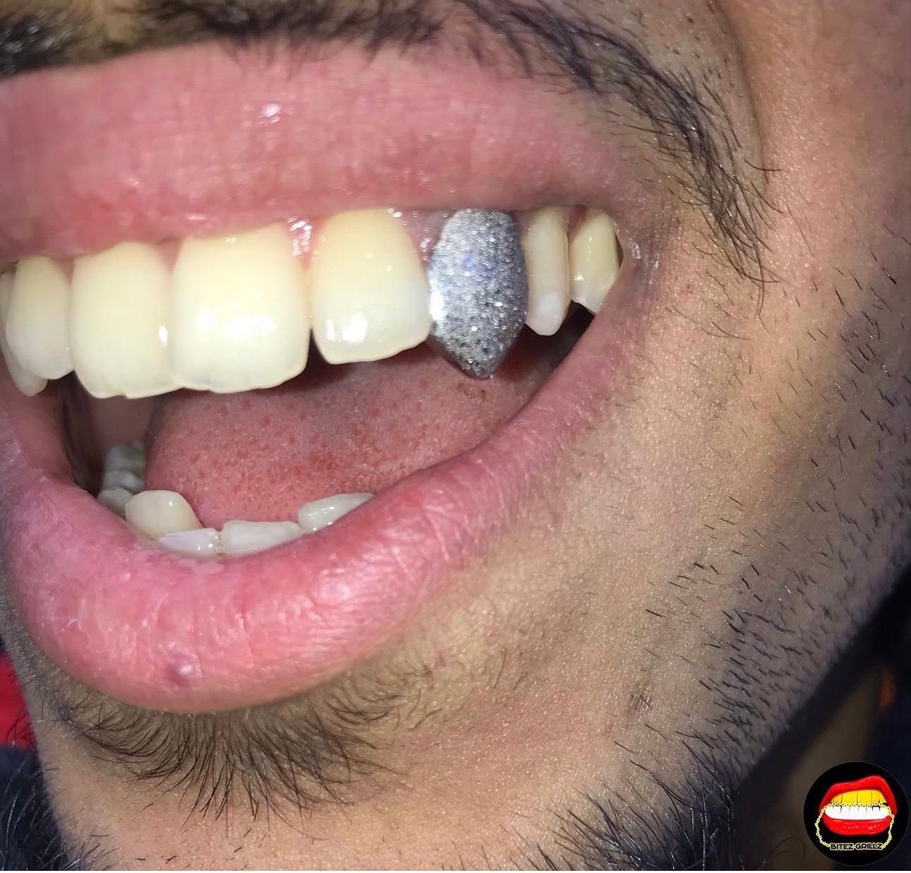 Canine Diamond Dust - Bitez Grillz