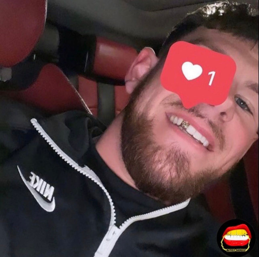 Lateral Diamond Dust Cut - Bitez Grillz