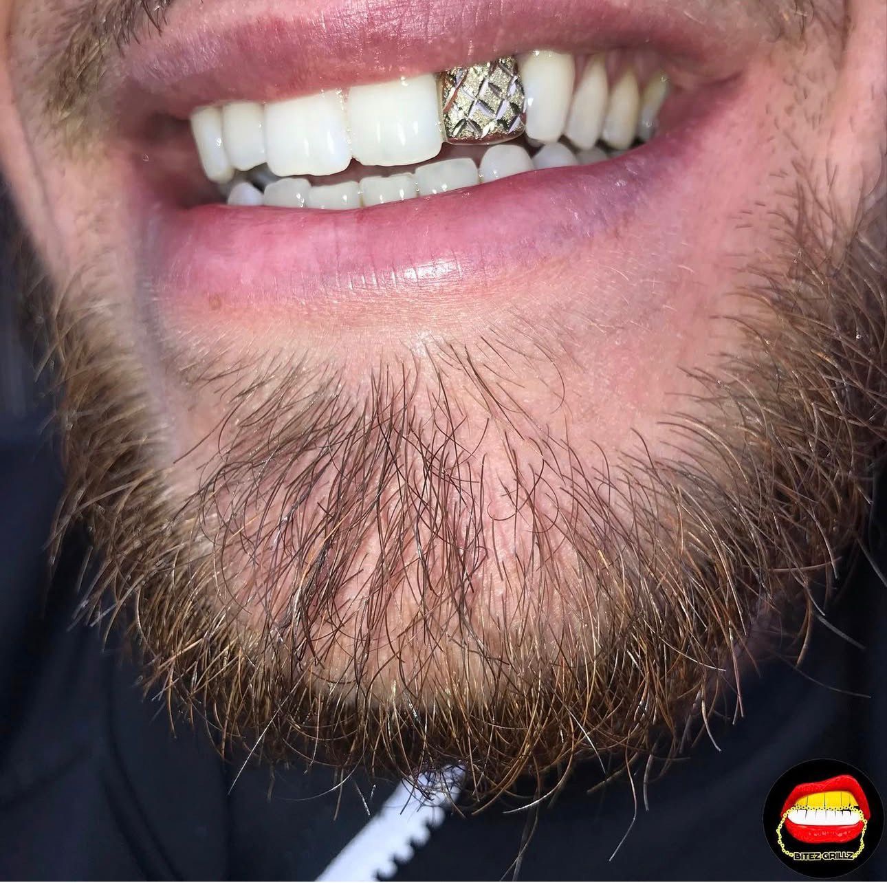 Lateral Diamond Dust Cut - Bitez Grillz