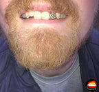 Lateral Diamond Dust Cut - Bitez Grillz
