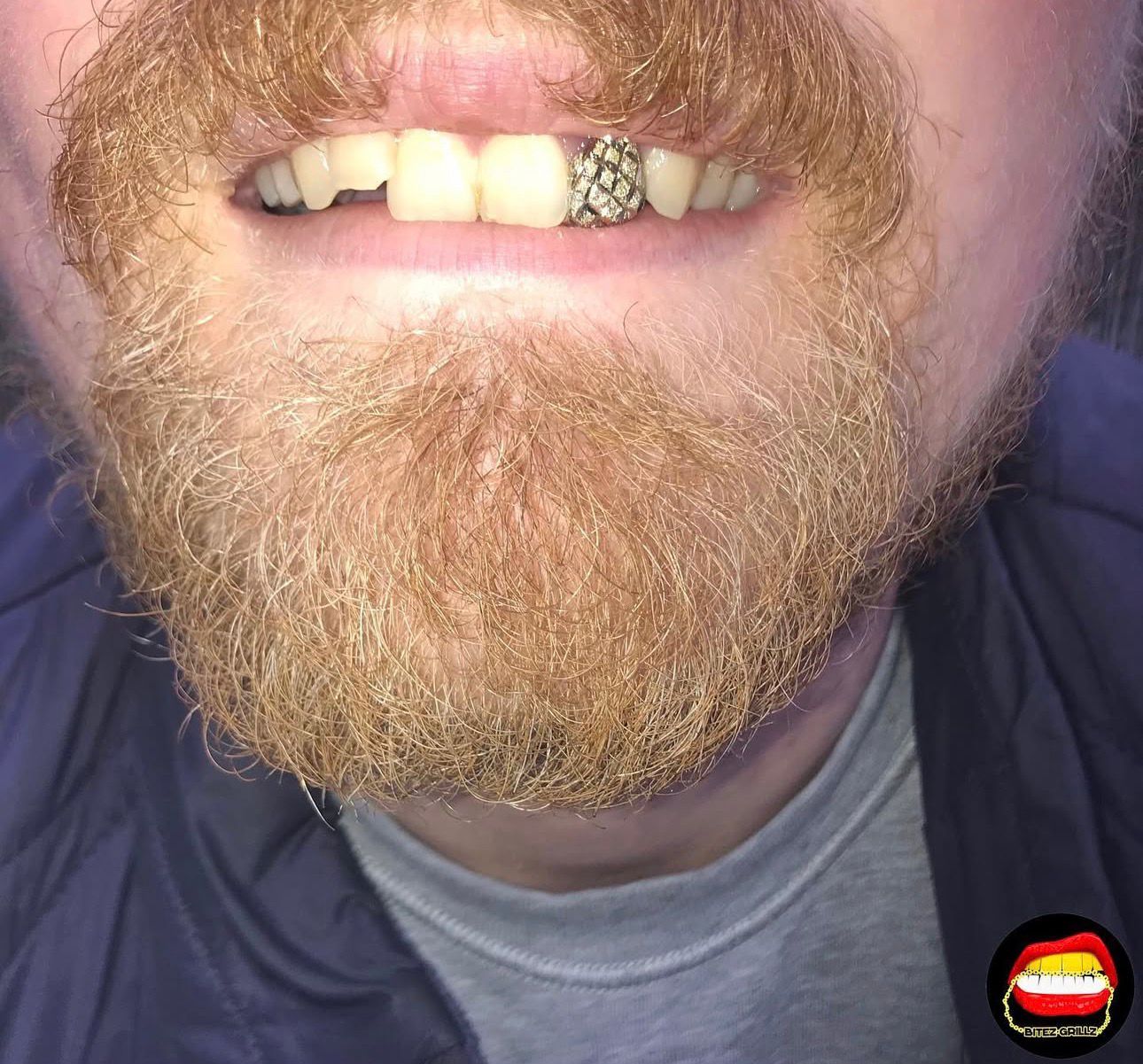 Lateral Diamond Dust Cut - Bitez Grillz
