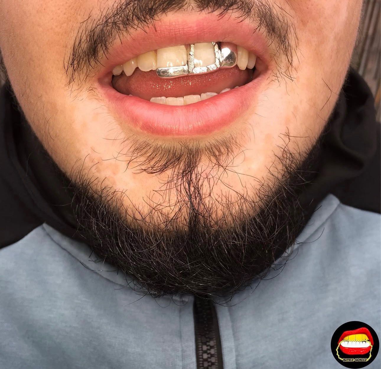 Plain Lateral - Plain Front Bar & Diamond Dust Cut Front Window - Bitez Grillz
