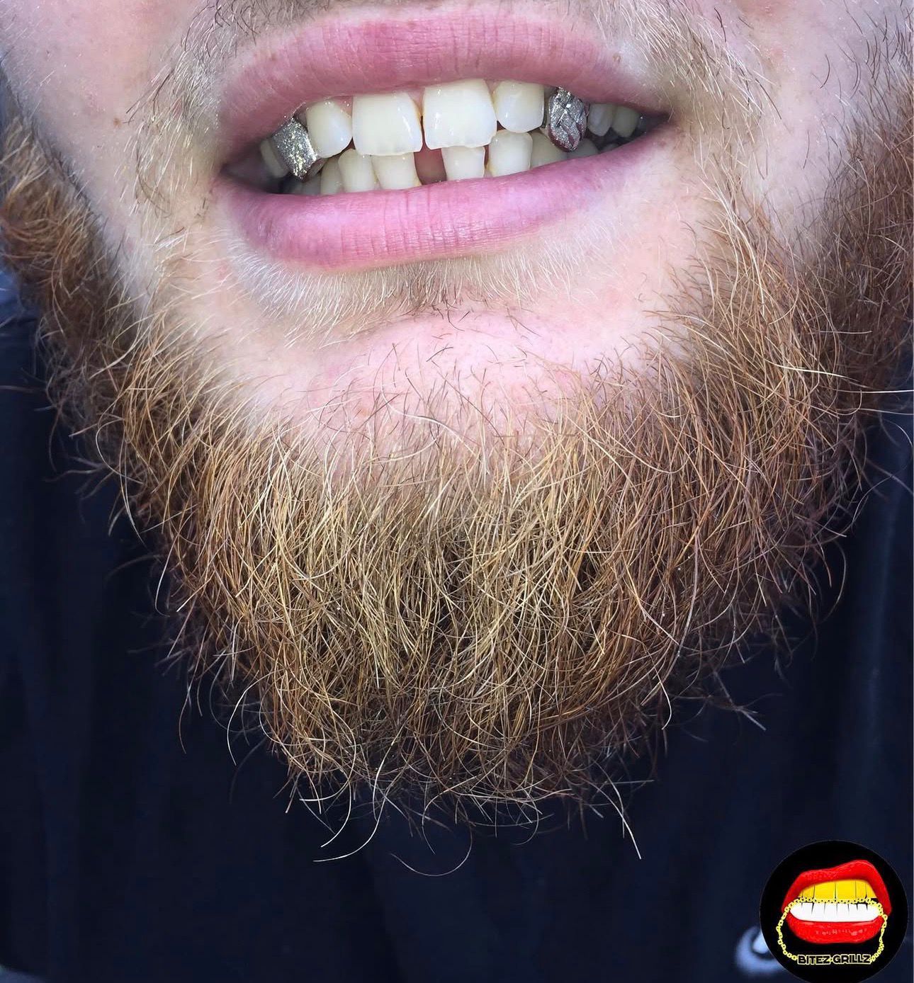 Canine - Canine Diamond Dust Cut - Bitez Grillz