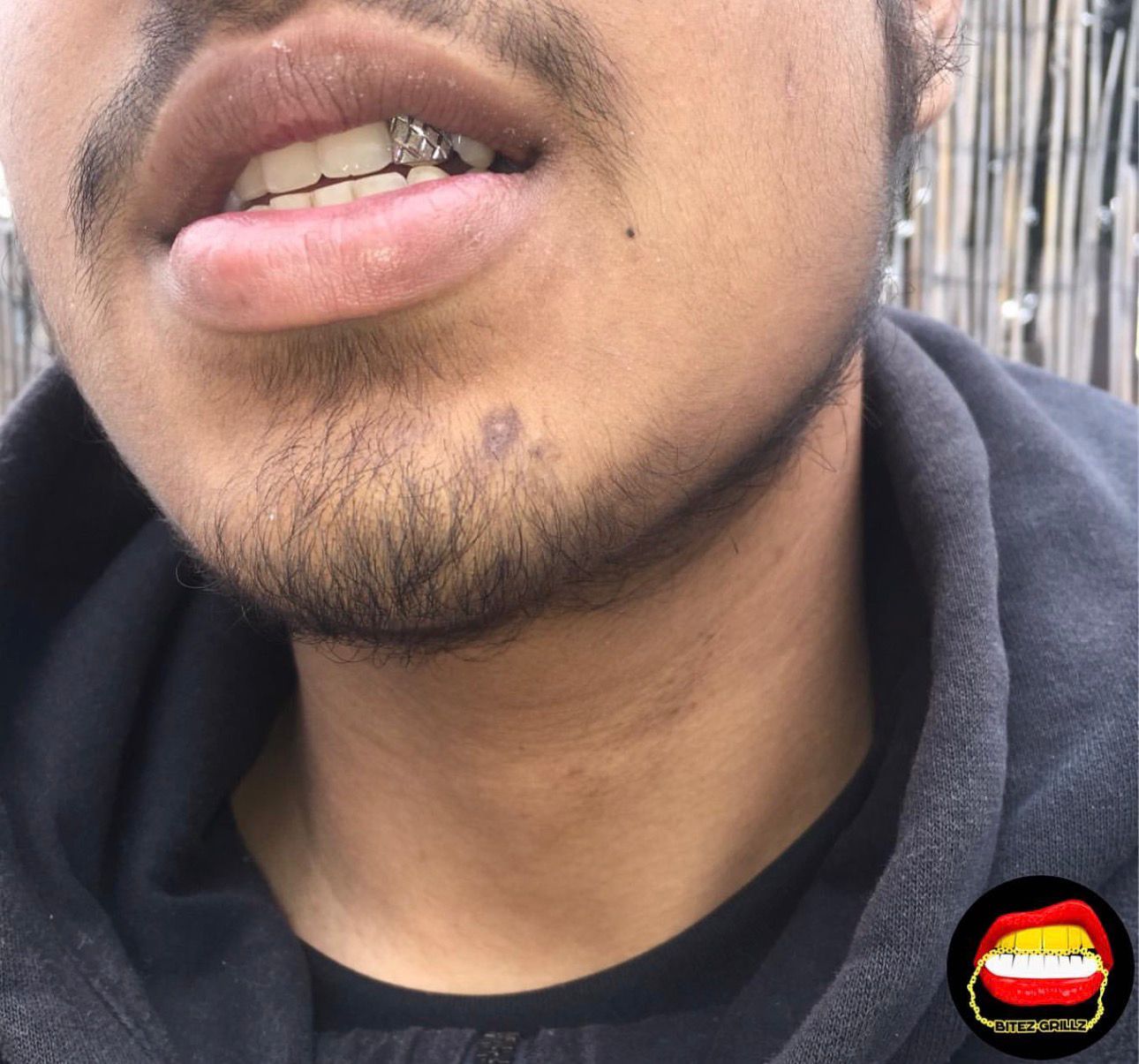 Lateral Diamond Dust Cut - Bitez Grillz