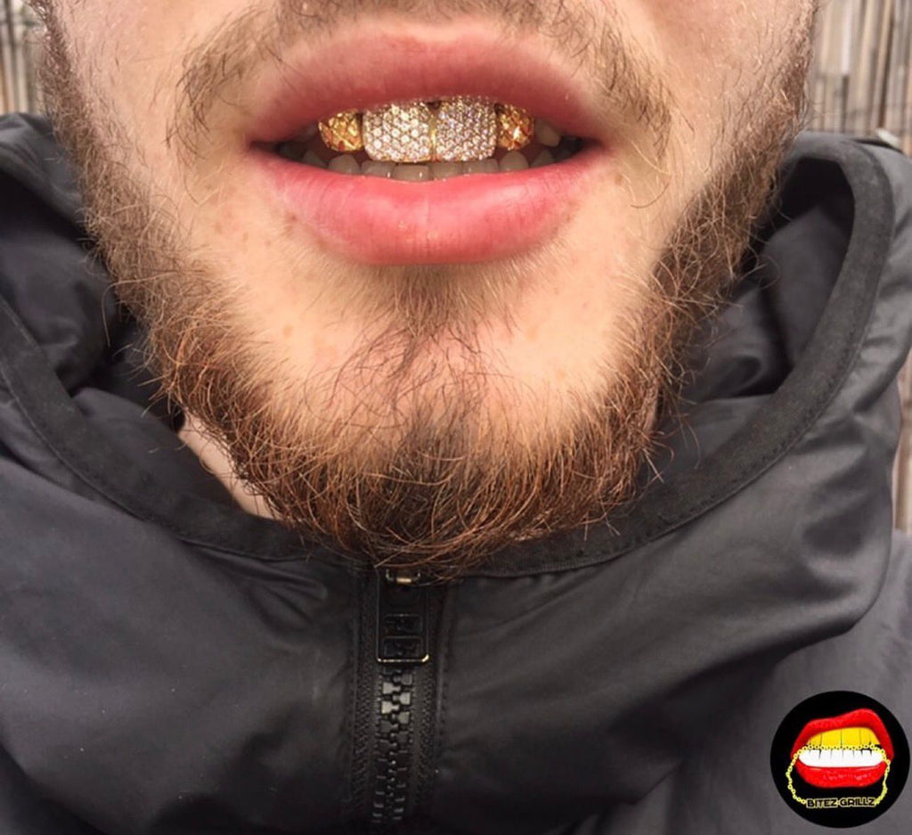 2 x Diamond Fronts - 2 x Laterals Diamond Dust Cut - Bitez Grillz