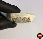 2 x Diamond Fronts - 2 x Laterals Diamond Dust Cut - Bitez Grillz