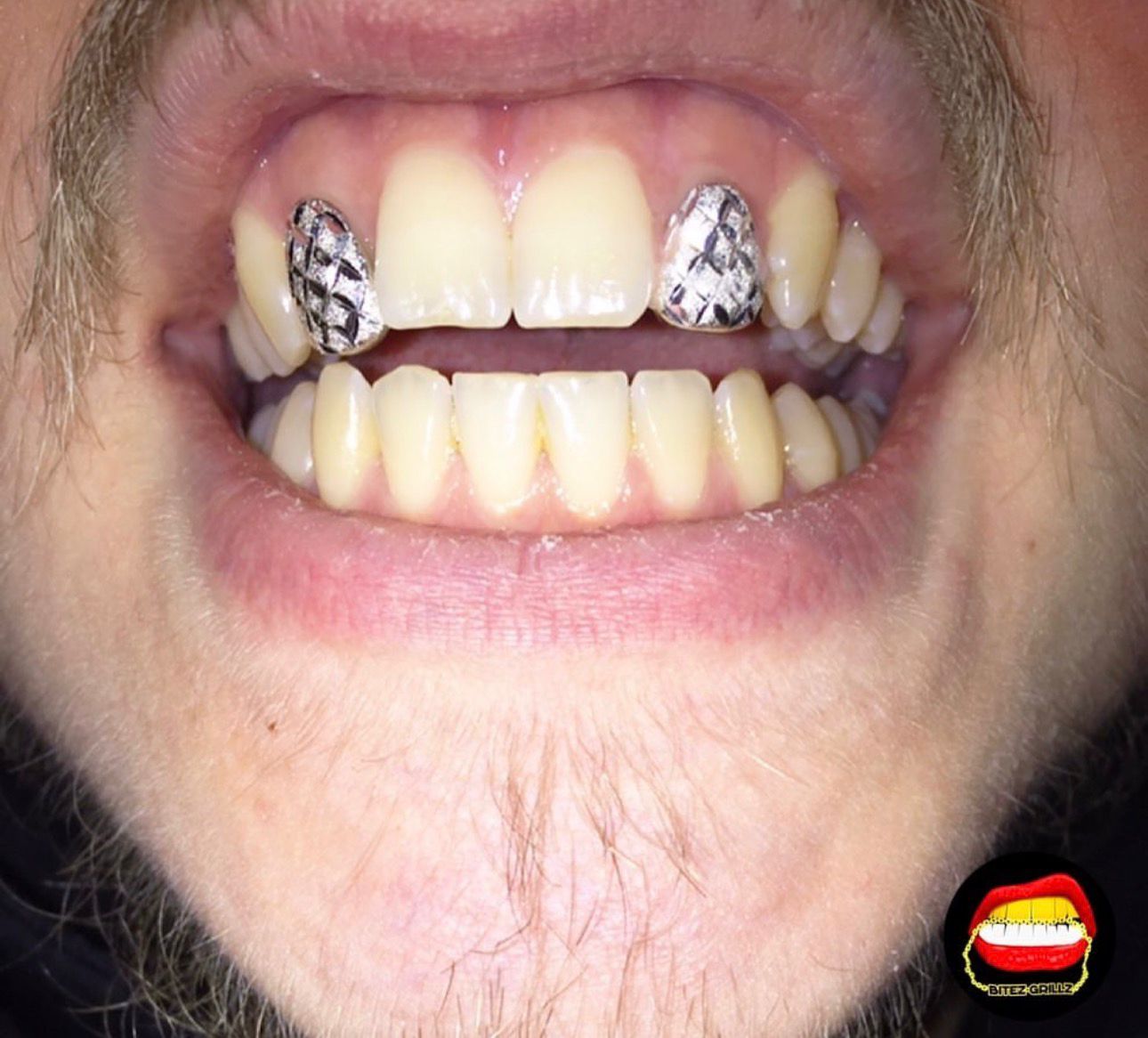 Lateral - Lateral Diamond Dust Cut - Bitez Grillz
