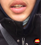 Front Tooth & Lateral - Bitez Grillz
