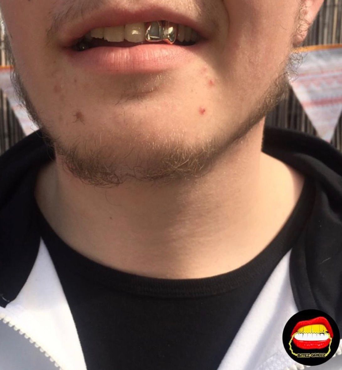 Window Lateral & Canine - Bitez Grillz