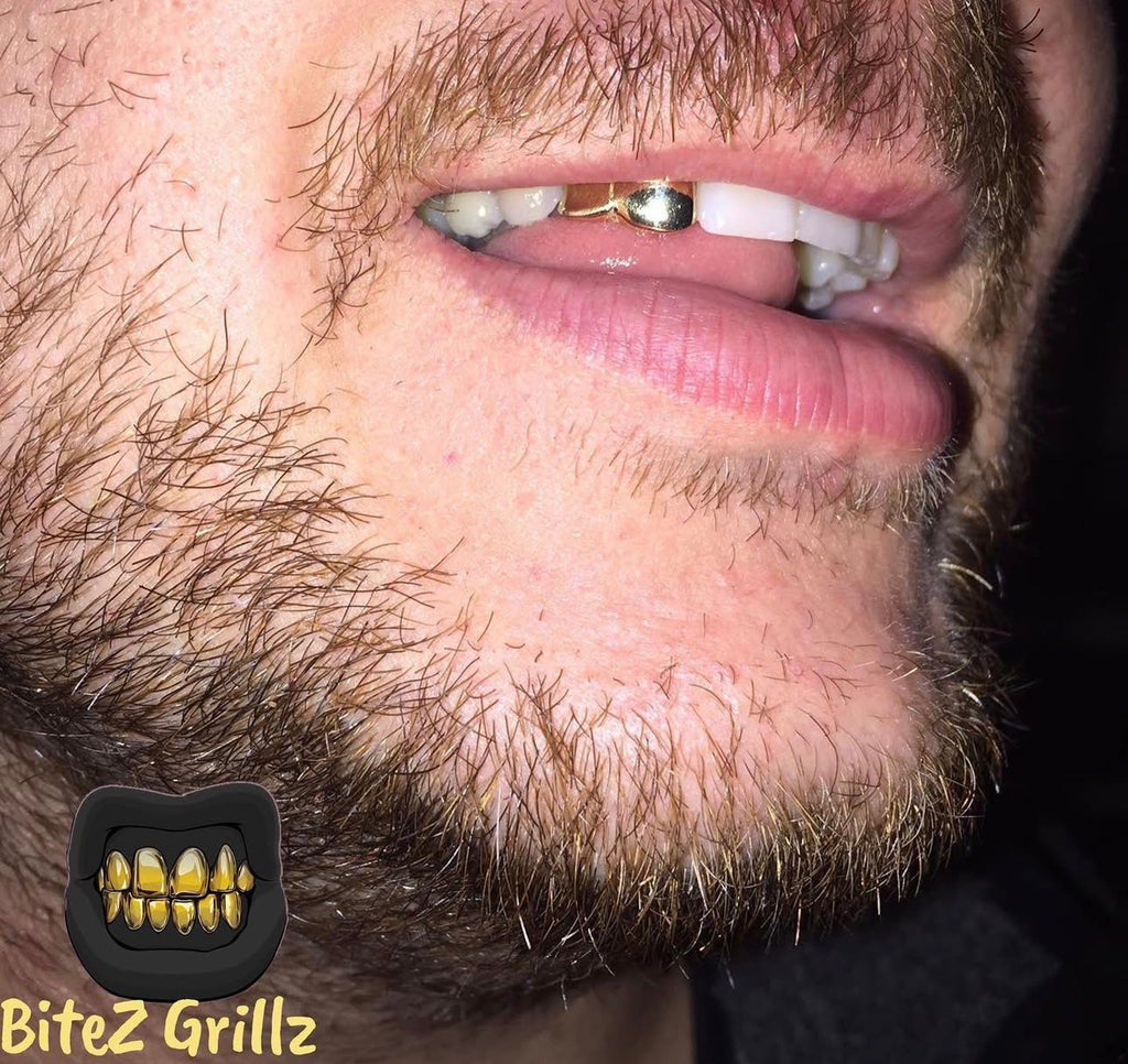 Lateral & Canine - Bitez Grillz
