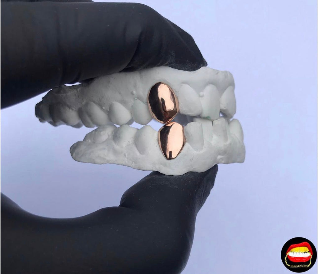 Upper Canine - Bottom Canine - Bitez Grillz