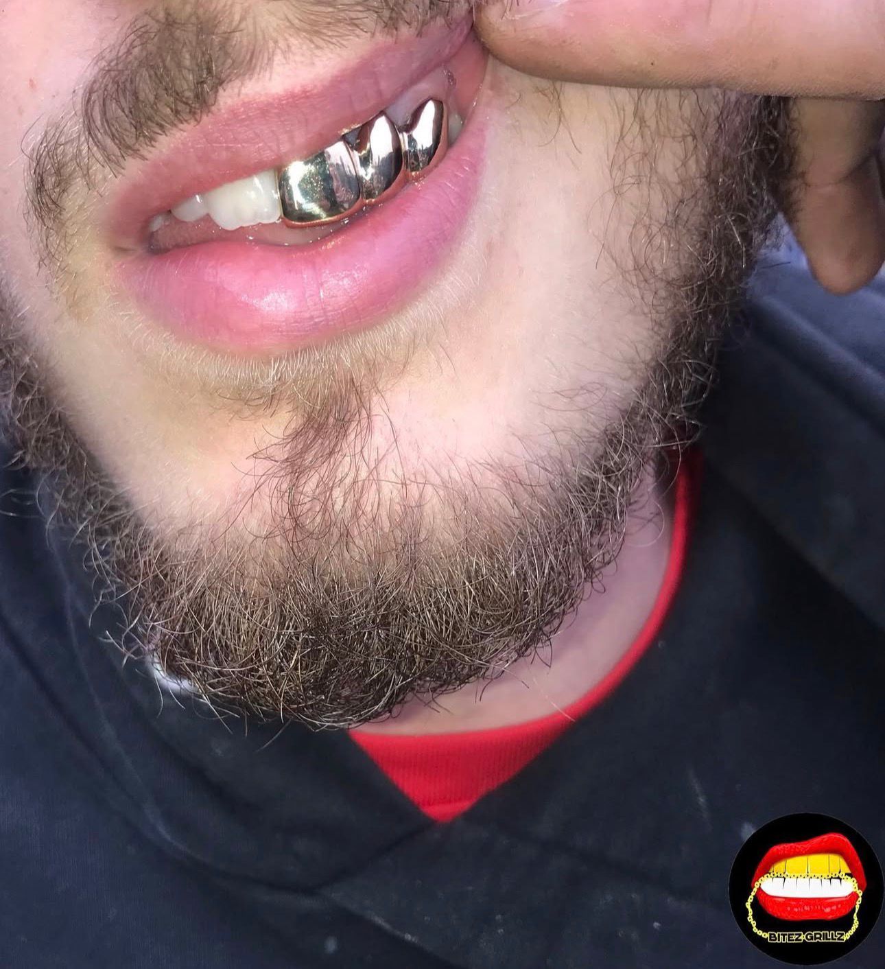 Front & Lateral & Canine - Bitez Grillz