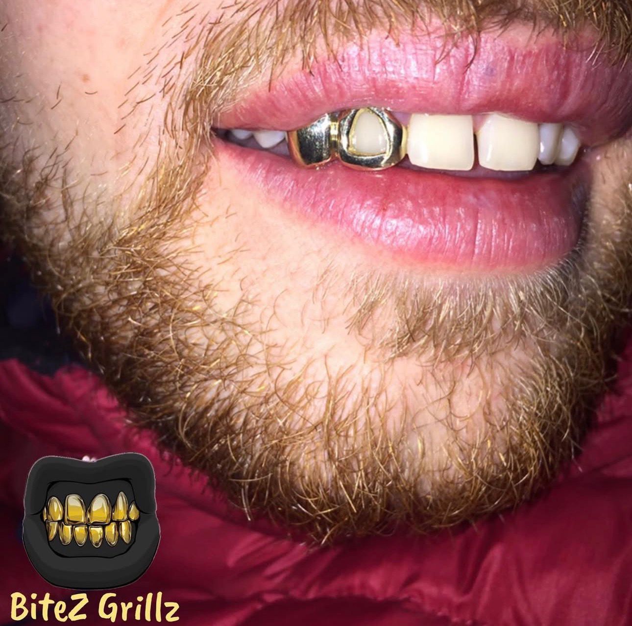Window Lateral & Canine - Bitez Grillz