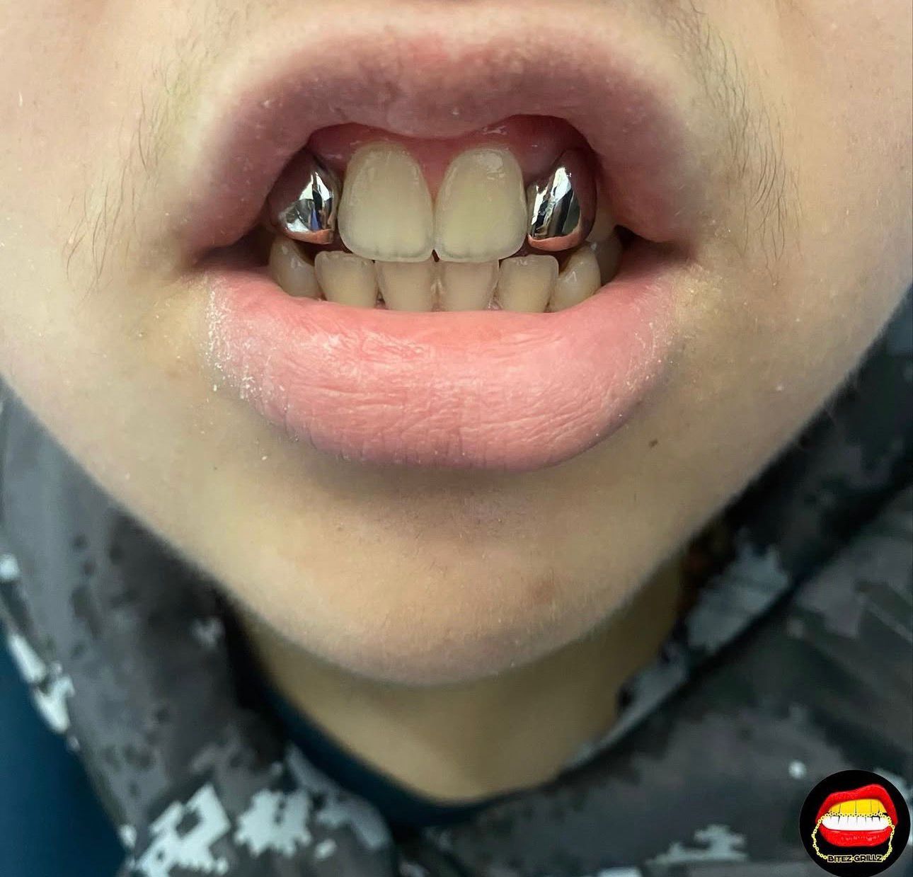 Lateral - Lateral - Bitez Grillz