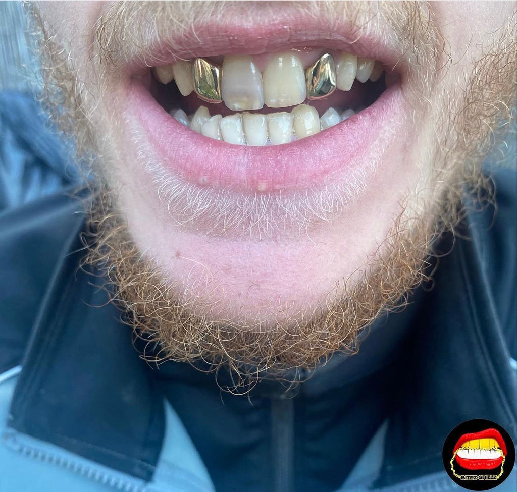Lateral - Lateral - Bitez Grillz