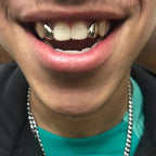 Lateral - Lateral - Bitez Grillz
