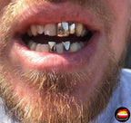 Lateral & Front (Bottom) - Bitez Grillz