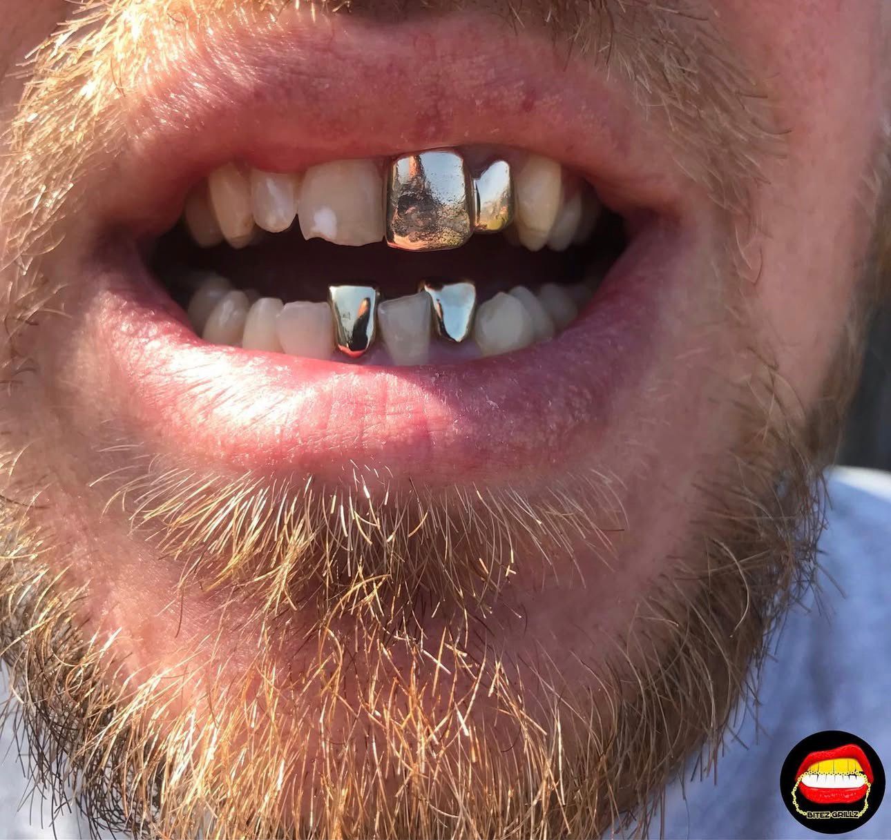 Lateral & Front (Bottom) - Bitez Grillz