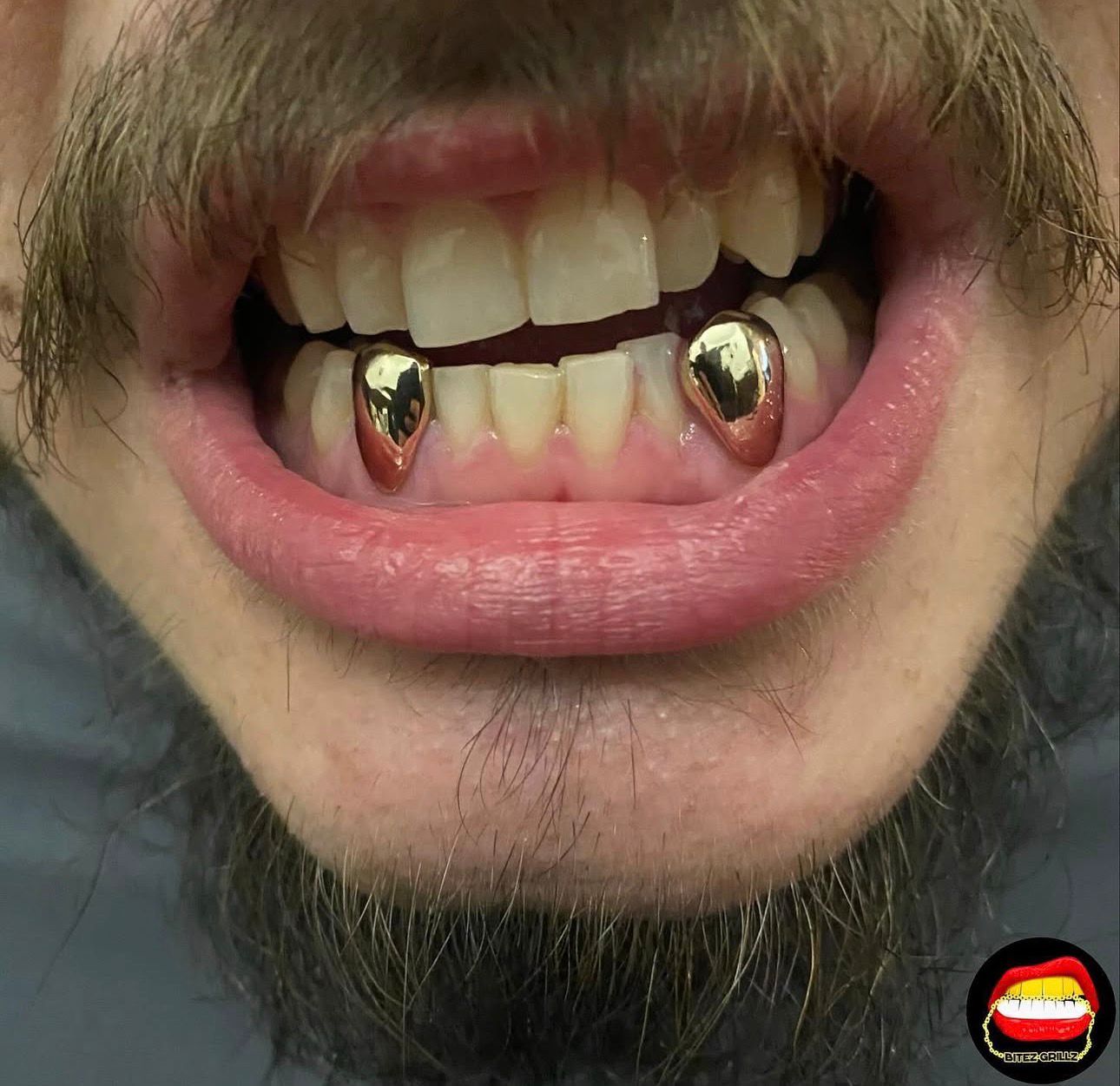 Canine - Canine (Lower) - Bitez Grillz