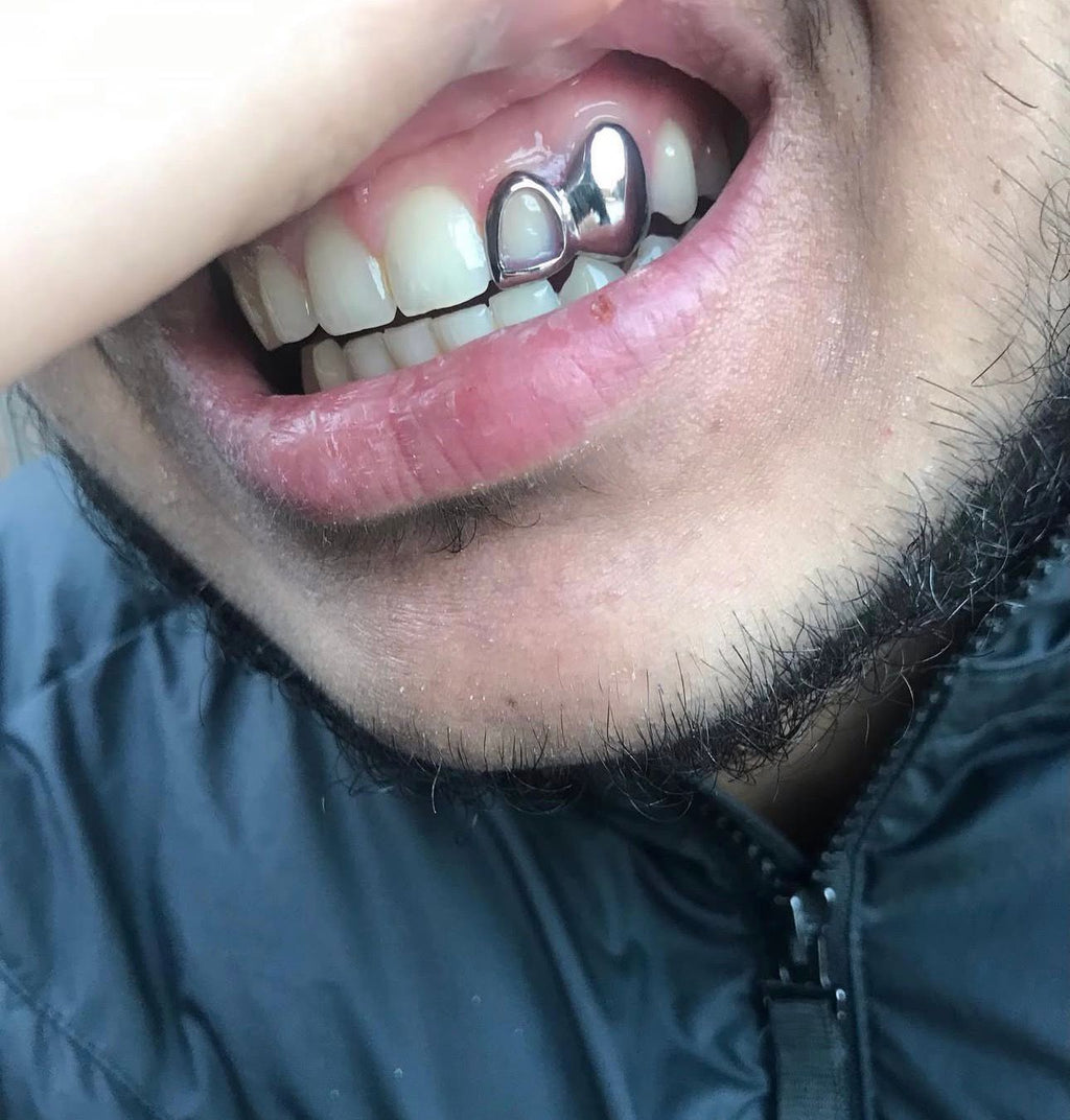 Window Lateral & Canine - Bitez Grillz