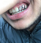 Window Lateral & Canine - Bitez Grillz