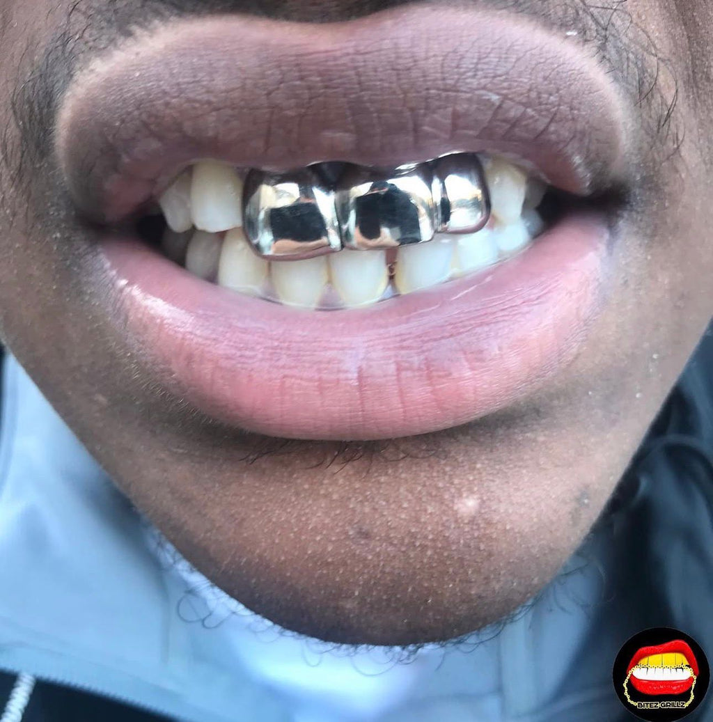 2 x Front & Lateral - Bitez Grillz