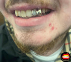 Window Lateral & Canine - Bitez Grillz