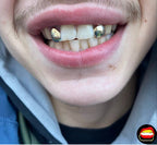Lateral - Lateral - Bitez Grillz