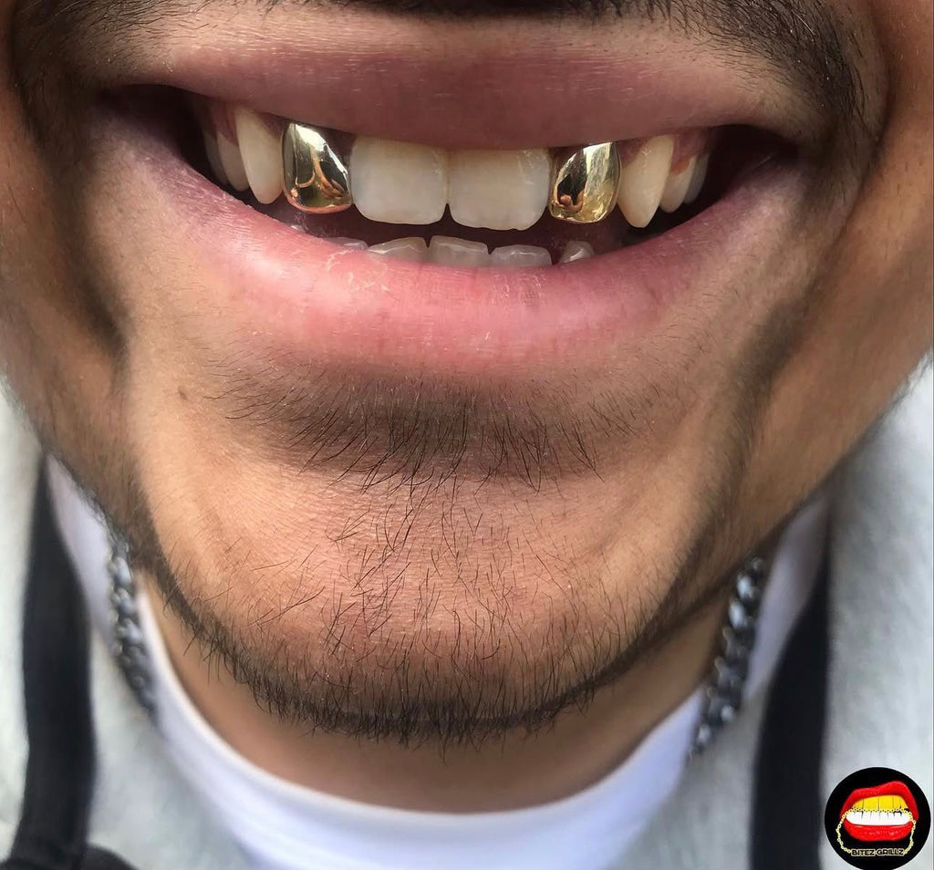 Lateral - Lateral - Bitez Grillz