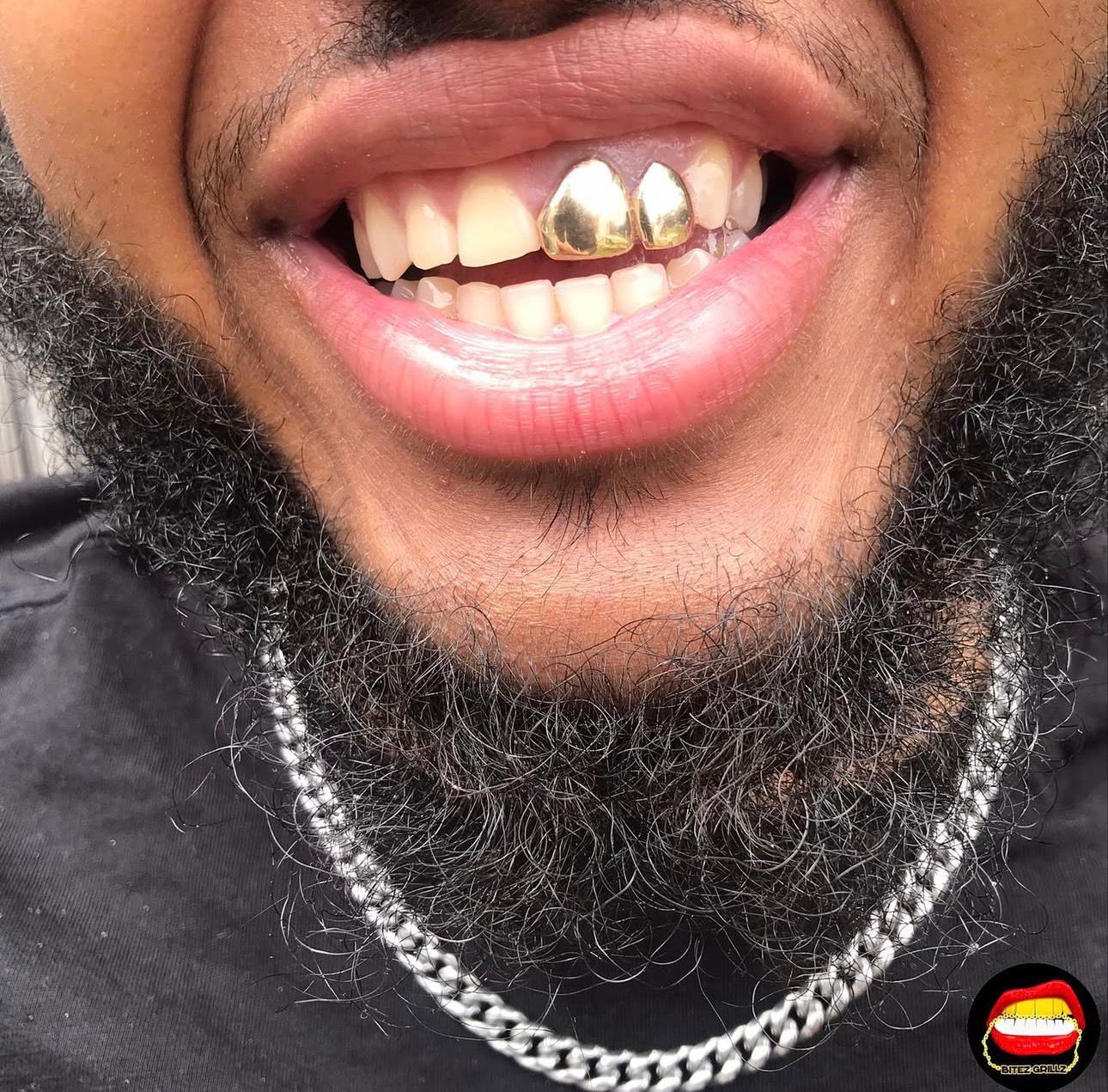 Front Tooth & Lateral - Bitez Grillz
