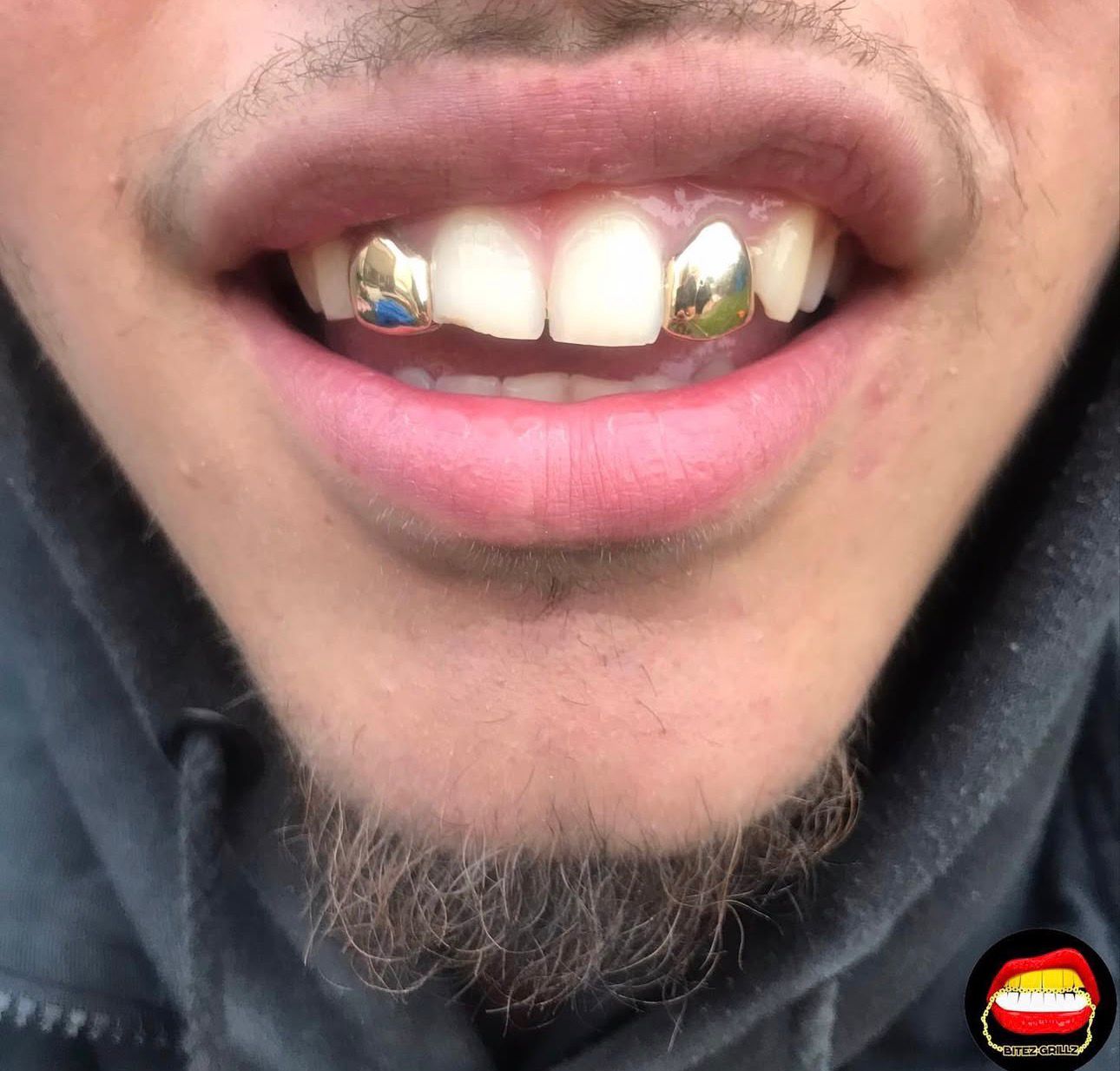 Lateral - Lateral - Bitez Grillz
