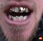 Upper Canine - Bottom Canine - Bitez Grillz
