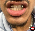 Lateral - Lateral - Bitez Grillz