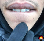 Lateral - Lateral - Bitez Grillz