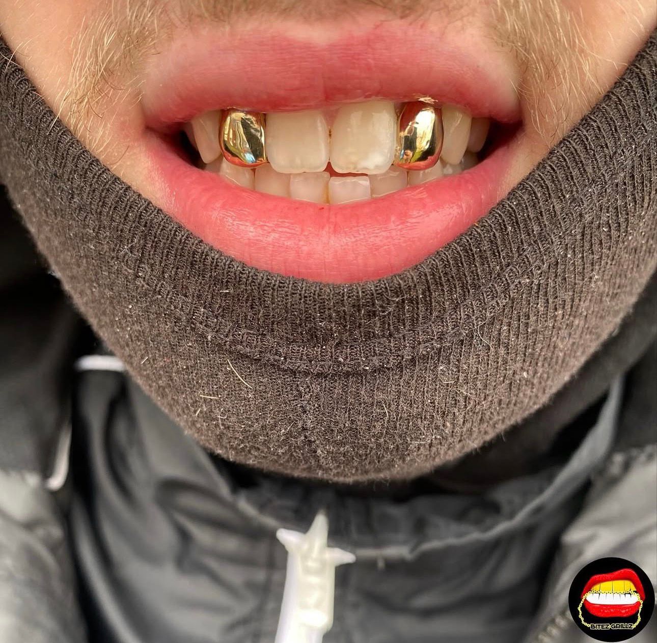 Lateral - Lateral - Bitez Grillz