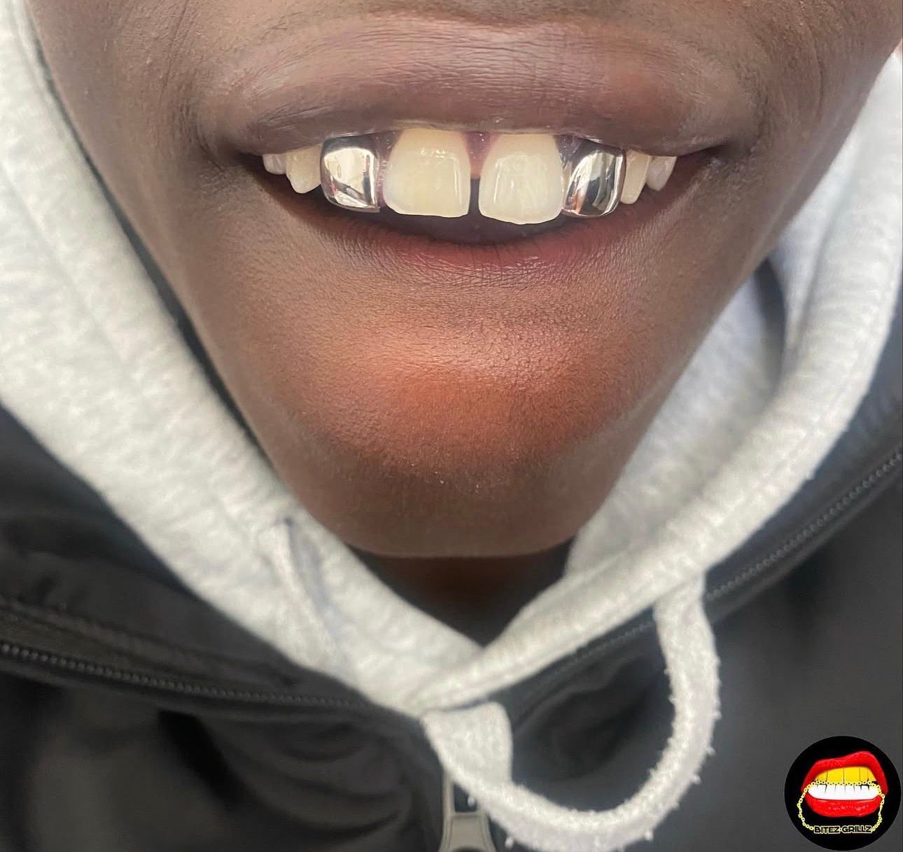 Lateral - Lateral - Bitez Grillz