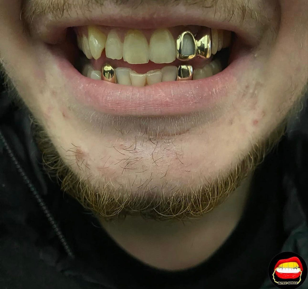 2 x Bottom Canine & Upper Window Lateral - Canine - Bitez Grillz