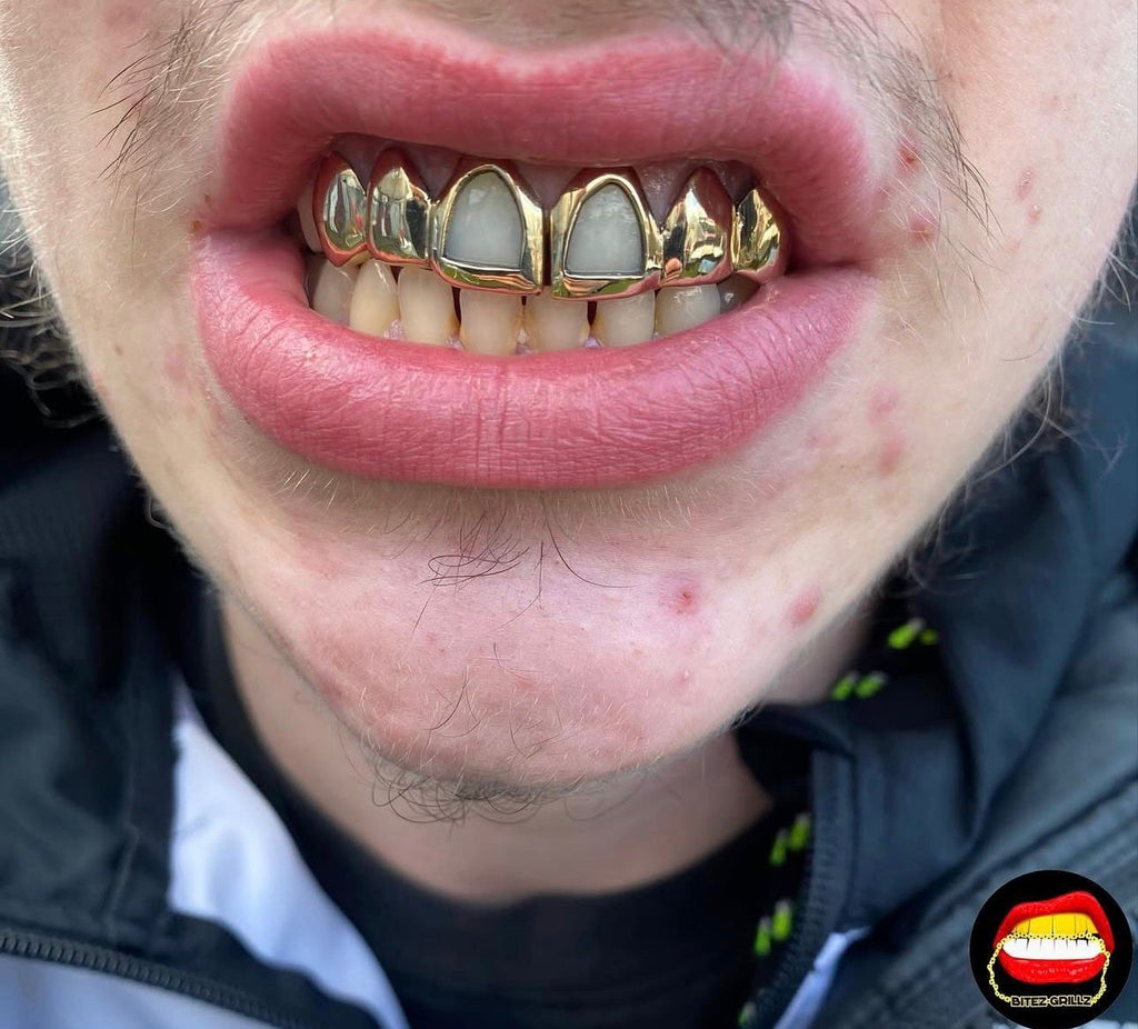Top 6 Set with 4 Solids & 2 Windows - Bitez Grillz