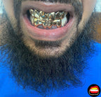 Top 6 - Bitez Grillz