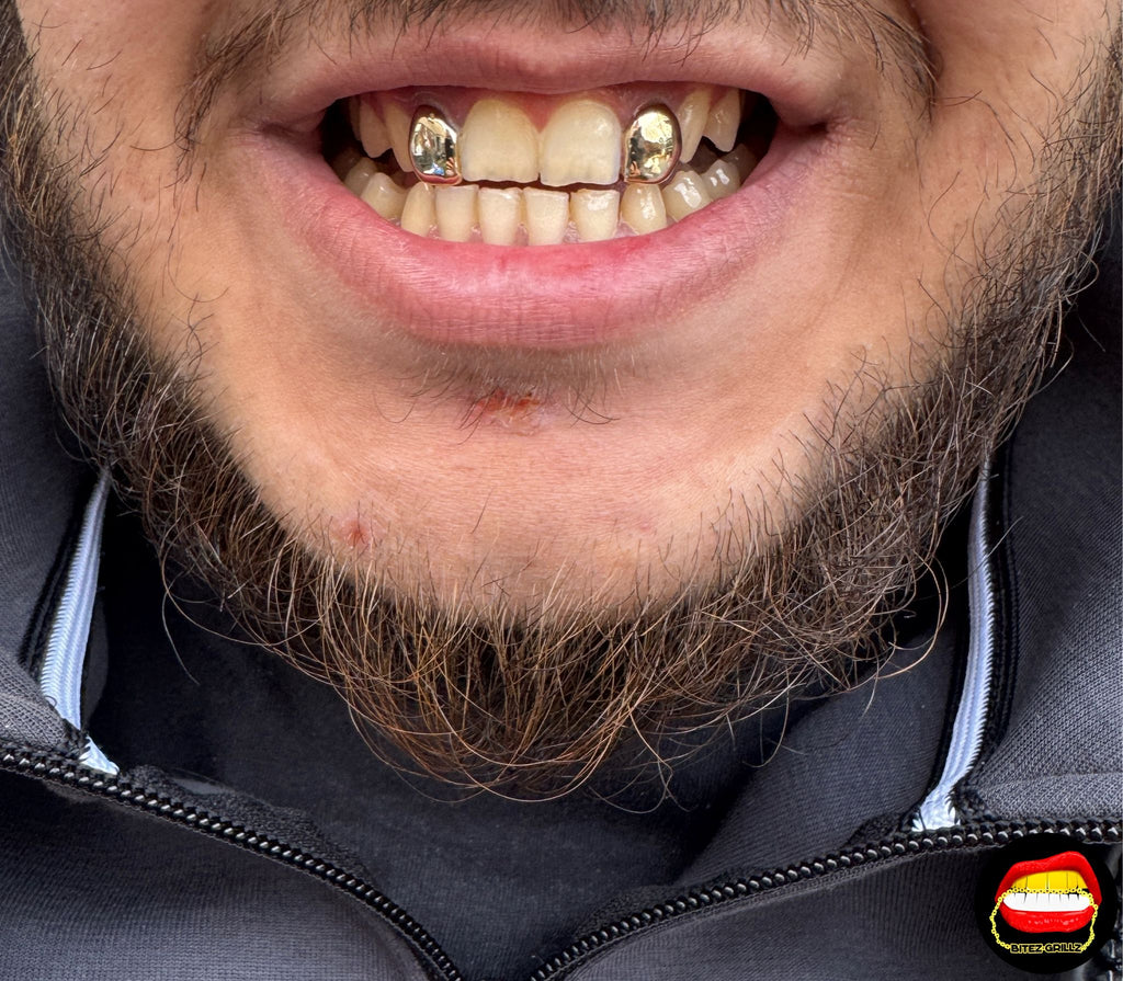 Lateral - Lateral - Bitez Grillz